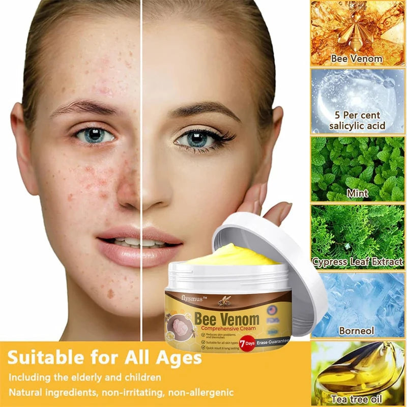 flysmus Bee Venom Comprehensive cream,flysmus Bee Venom Cream, Visibly reduces skin blemishes and smoothes skin (3)