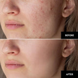 Skaind Collagen Glow Mask Overnight - HydraGlow Deep Face Mask, Bio-Collagen Mask, Hydrating Overnight Hydrogel Mask, Revitalize Your Skin with Low Molecular Weight Collagen Mask (1 box of 4 pieces)