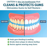 Unitein UNITEIN Gum Restore Toothpaste, Improves and protects damaged & bleeding gums, Breaks Down Plaque, Resists Tarter, Plant-based Formula, 99% Natural Ingredients, Free of Fluoride, Triclosan, Microbeads