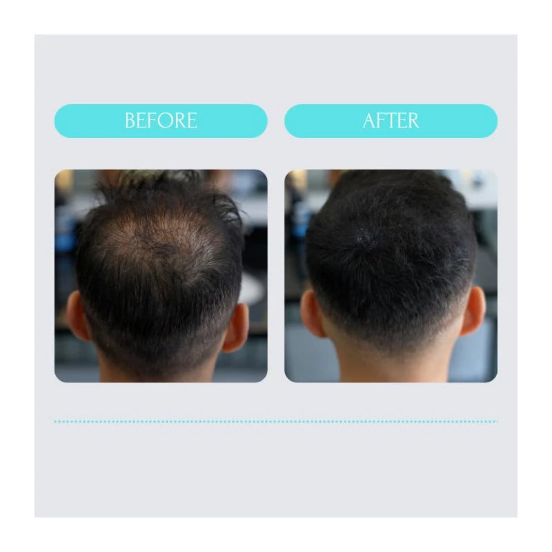 Batcı Hair Atelier Liquid Hair Concealer for Thinning Hair and Bald Spots | Luxury Long-Lasting Root Touch Up with Color Thickening Fibers | Professional, Natural-Looking Hair Coverage