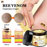 AEEHFENG LOVILDS Bee Venom Cream, Professional Bee Venom Skin Treatment Cream, LOVILDS Bee Venom Repair Cream for All Skin Types (1 Bottle)