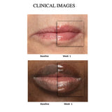 NuSkin Nu Skin Nu Colour Peptide Pout New Sealed