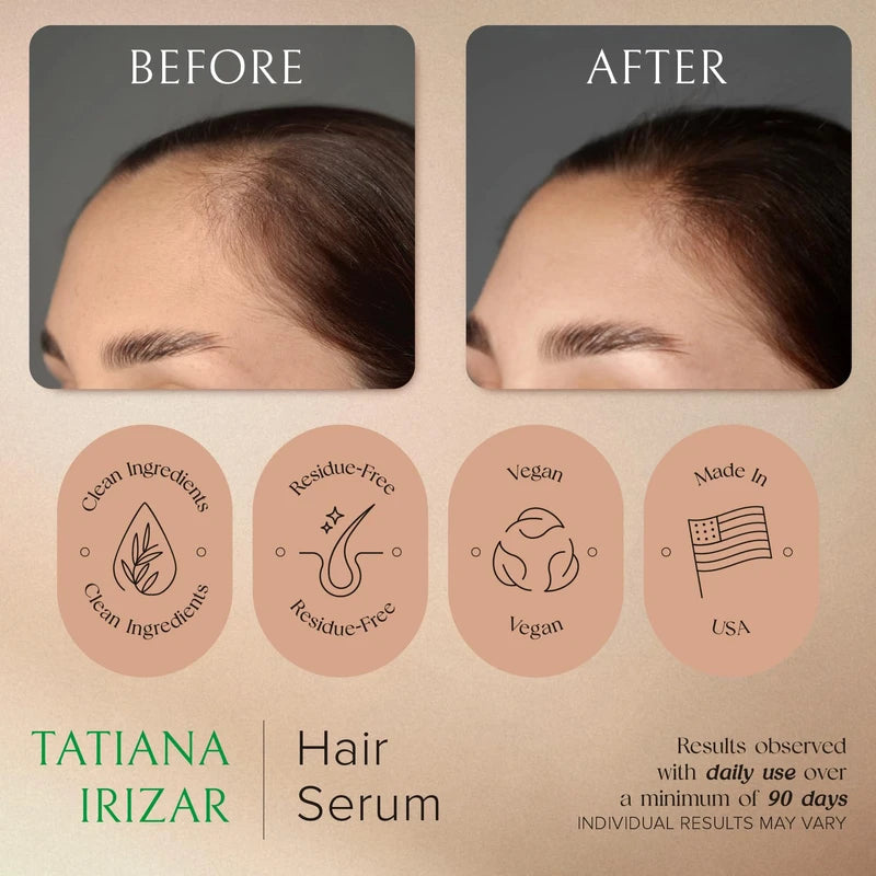 Tatiana Irizar Hair Serum for Hair Growth Serum Women Made in USA - 2 Pack Scalp Serum for Hair Growth Non-Greasy Rosemary & Amla Hair Care Vegan 1 Oz Hair Loss Treatment for Women Hair Regrowth Treatment for Women