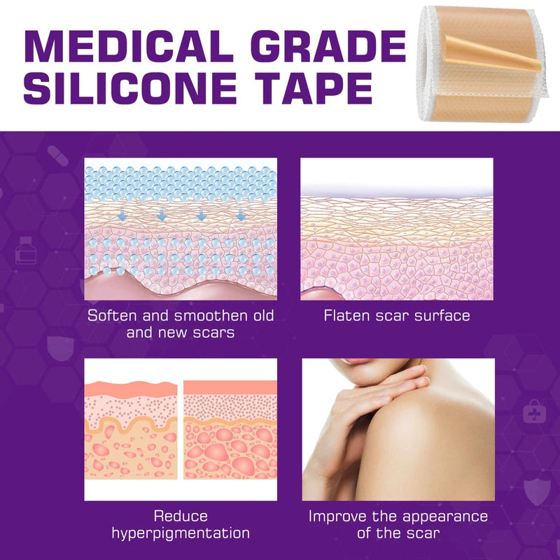 Kelinul Silicone Scar Sheets(1.6 x 120"Roll-3M) Scar Removal Silicone Scar Tape for Softening and Flattening Scars, Acne, C-Section, Keloid Surgery, Painless Removal, Reusable, Washable, 10-12 Month Supply