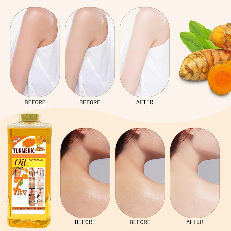 nedraho nedraho Soft 7 Turmeric Body Oil,Soft 7 Turmeric Oil,VeetGold Body Oil,Soft 7 Body Oil for Face & Body Moisturizer,Soft 7 Oil Natural Moisturizing Body Oil for All Skin Types (7 oz/Bottle)