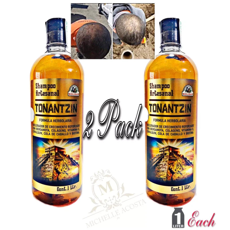 Nolisan 2 Hair Re-Growth Shampoo With Rosemary, Collagen & Copalquin TONANTZIN 1L Each
