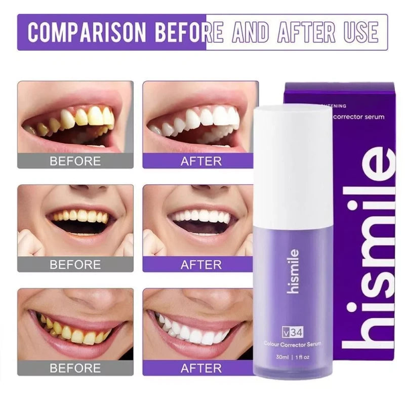 Hismile v34 Colour Corrector Serum Purple Teeth Whitening Tooth Stain Removal US