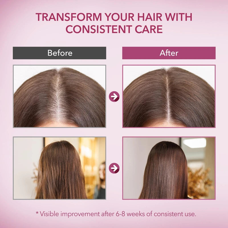 ProBliva Onion & Rosemary Hair Growth Shampoo: Biotin Infused Shampoo for Hair Loss and Thinning Hair - Promotes Healthier, Thicker and Stronger Hair for Women and Men - 16.9 oz