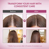 ProBliva Onion & Rosemary Hair Growth Shampoo: Biotin Infused Shampoo for Hair Loss and Thinning Hair - Promotes Healthier, Thicker and Stronger Hair for Women and Men - 16.9 oz
