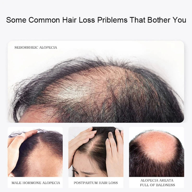 Lidoria Ginger Anti Hair Loss 7 Days, Ginger Essential Oil for Hair Growth Stronger and Fuller Hair, Hair Growth Serum for women for Dry Damaged Hair, Thicker Longer Hair (1.2 Oz(Pack of 2))