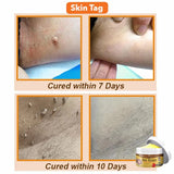 flysmus Bee Venom Comprehensive cream,flysmus Bee Venom Cream, Visibly reduces skin blemishes and smoothes skin (3)