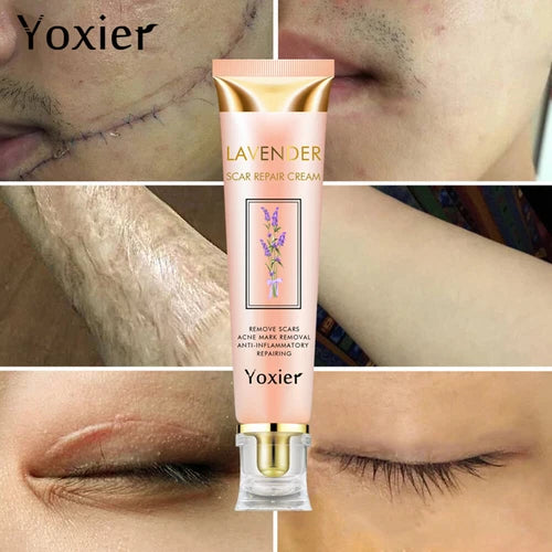 Yoxier Lavender Scar Repair Cream Anti Stretch Marks Cream Scar Removal Cream