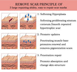 Yoxier Lavender Scar Repair Cream Anti Stretch Marks Cream Scar Removal Cream