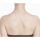 Acupuncture 30 Needles