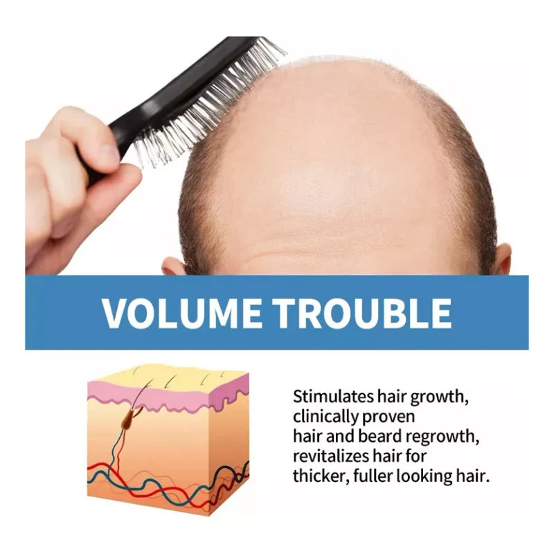 generic 3pzs Sérum Crescimento Capilar Re:act Minoxi Roll-on Hair