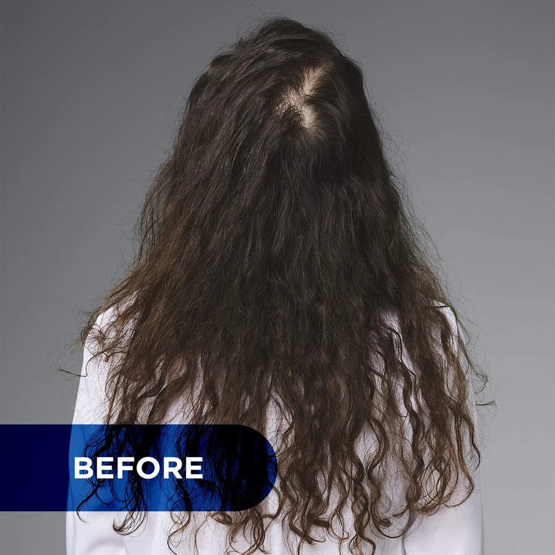 L'Oreal Professionnel Serioxyl, Denser Hair Serum,For Men and Women with Thinning Hair or Hair Loss, Daily Scalp Treatment, 90 ml