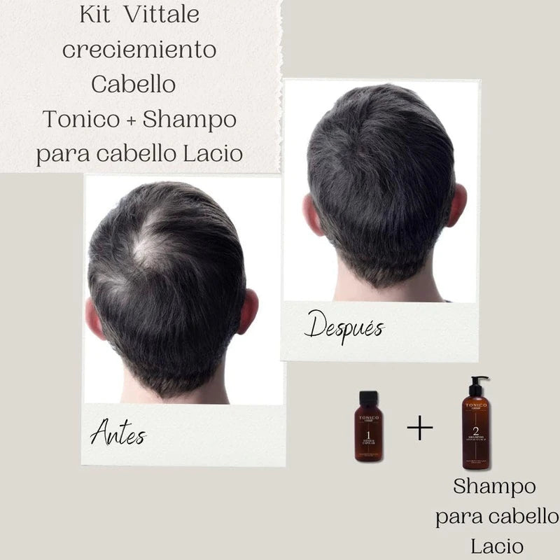 Tonico Vittale Kit 2 Paquete Tónico Y Shampoo Para Cabello Lacio | Unisex | Paso 1 y 2 | Crecimiento Y Fortalecimiento Capilar | Brillo Y Reconstrucción | Control del Frizz | 100% Ingredientes Naturales