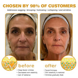 Furzero Bee Venom Wrinkle Removal Cream, Furzero Bee Venom Anti-Wrinkle Cream, Advanced Skin Firming Cream, Anti-Aging Moisturizer for Face & Neck,Anti-Aging Bee Venom Cream (2pcs)