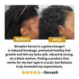 BIONPLEX 100% Organic Hair Growth Serum For Thinning Hair Loss - More Bottles:: 1 Pics