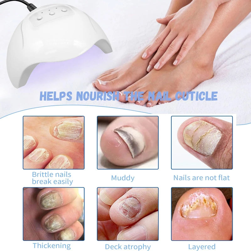 Light Therapy Nail Fungus Laser Device Against Nail Fungus, Laser Nail Fungus Remover, Rechargeable Portable Pure Nail Laser, Pure Nail Fungus Laser Therapy Device, Nail Fungus Treatment Quick