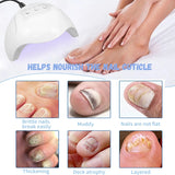 Light Therapy Nail Fungus Laser Device Against Nail Fungus, Laser Nail Fungus Remover, Rechargeable Portable Pure Nail Laser, Pure Nail Fungus Laser Therapy Device, Nail Fungus Treatment Quick