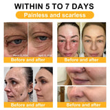 Bee Venom Comprehensive Cream, Professional Bee Venom Skin Treatment Cream for Removing and Repair, Natural Bee Venom Cream Suitable for All Skin Types (3PC)