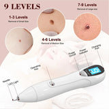 Breaspec LM 1000 SkinTag Remover Home Use, Removal of Common Warts, SkinTags | Easy to Use