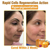 Daasry Bee Venom Skin Treatment Serum Cream, 2025 New Professional Bee Venom Skin Treatment Cream, Daasry Skin Repair Cream, Repair, moisturize and lift 3 in 1, for All Skin Types (3 Bottle)