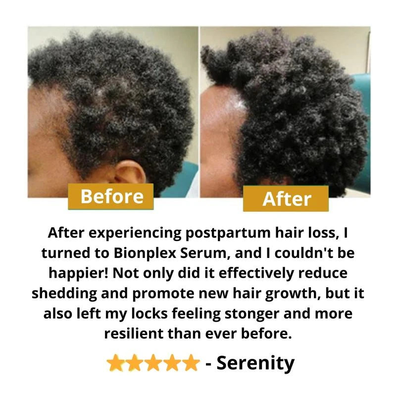 BIONPLEX 100% Organic Hair Growth Serum For Thinning Hair Loss - More Bottles:: 6 Pics