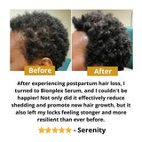 BIONPLEX 100% Organic Hair Growth Serum For Thinning Hair Loss - More Bottles:: 6 Pics