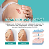 South Moon （Buy 1 Get 1 Free）South Moon Scar Care Spray Fades Scare pregnancy  Smoothing Skin Care Spray Medical Grade Scar Spray - Specification: Buy 2 Get 2 Free