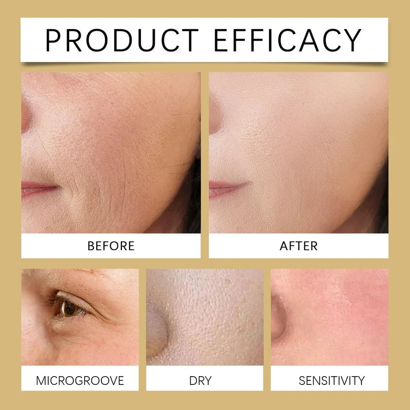 Rapid Immune Recovery Hydrating Serum, Anti Wrinkle Serum, Anti-Aging Serum, Smoothing Facial Serum, Moisturiser Face, Centella Face Serum for Skin Repair, Tighten Skin, Improve Sagging, Fine Lines